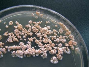 Nontuberculous Mycobacteria (NTM) Infections Mycobacterial